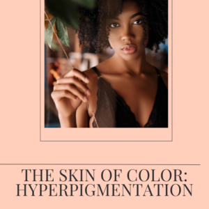 The Skin of Color: Hyperpigmentation