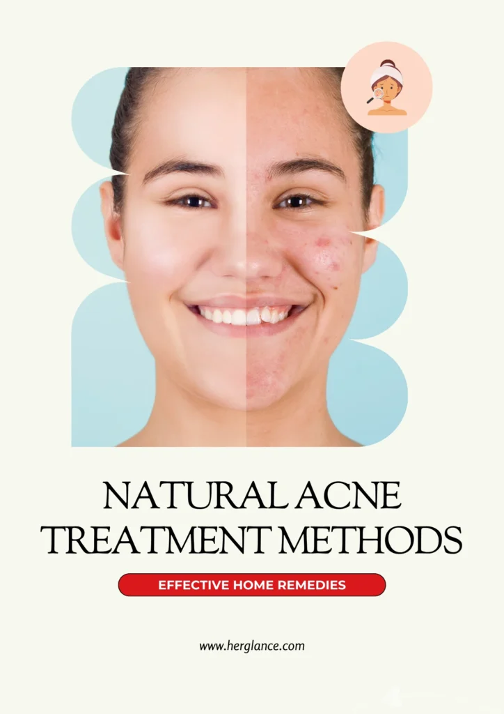 Natural Acne Treatment Methods
